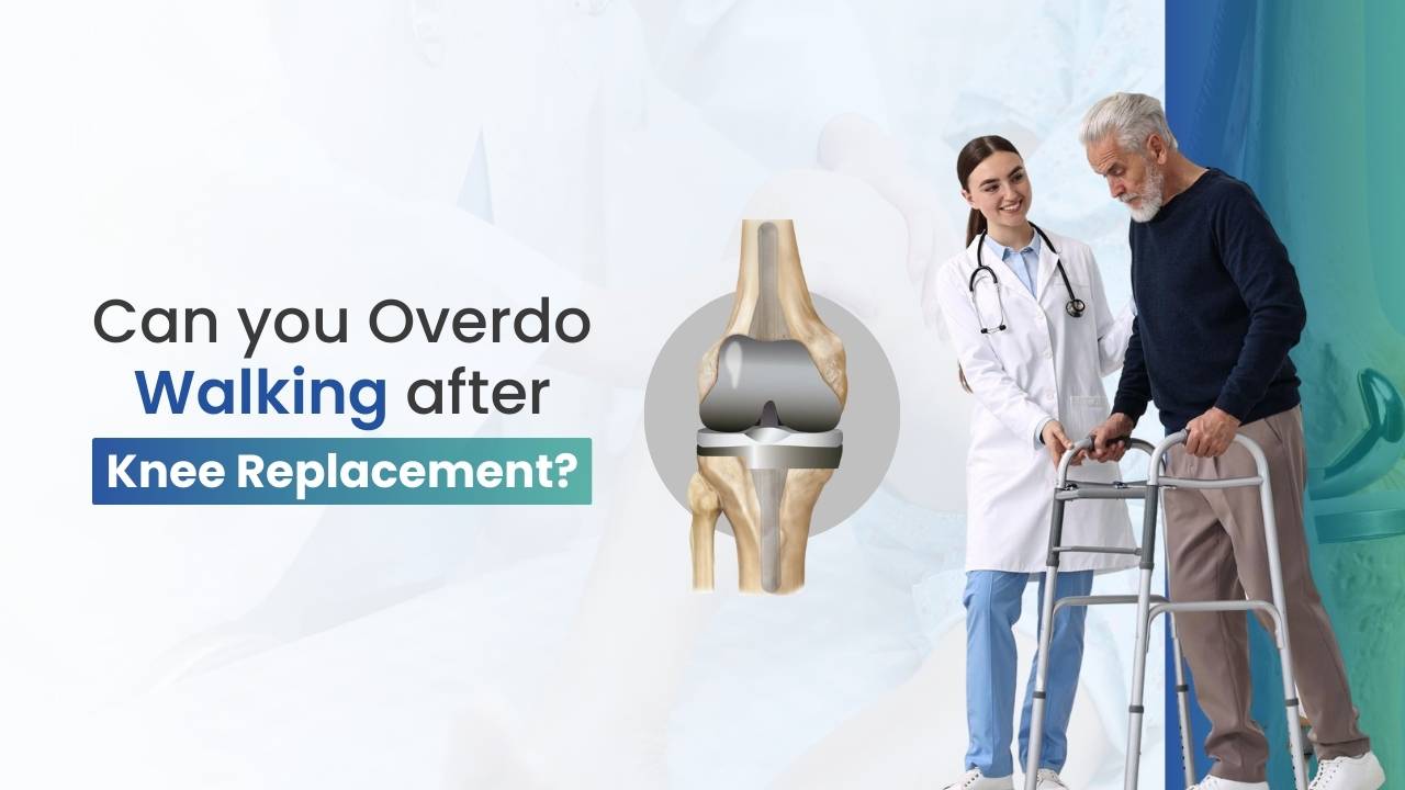 Can you Overdo Walking Knee Replacement